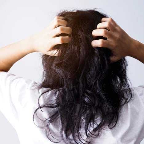 "الثوم" علاج فعّال لتساقط الشعر