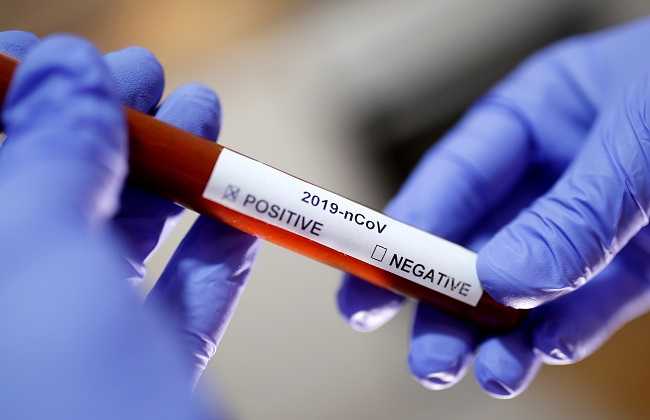 "خطة الدولة الشاملة في مكافحة فيروس كورونا وتوفير اللقاحات"