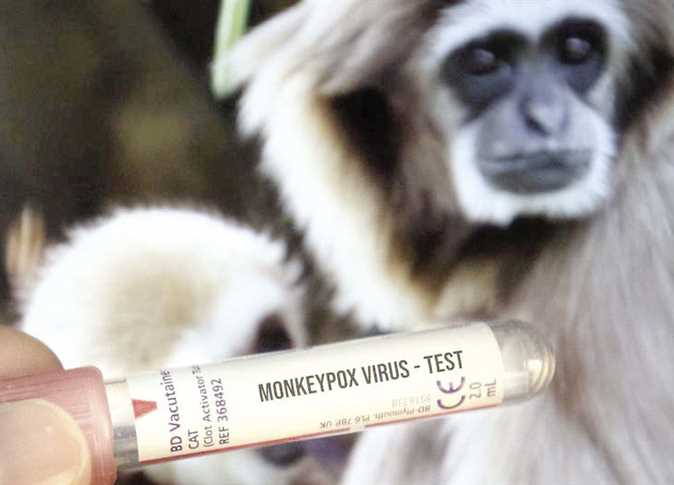 عدد حالات الإصابة بجدري القرود يتجاوز 100 في اليابان
